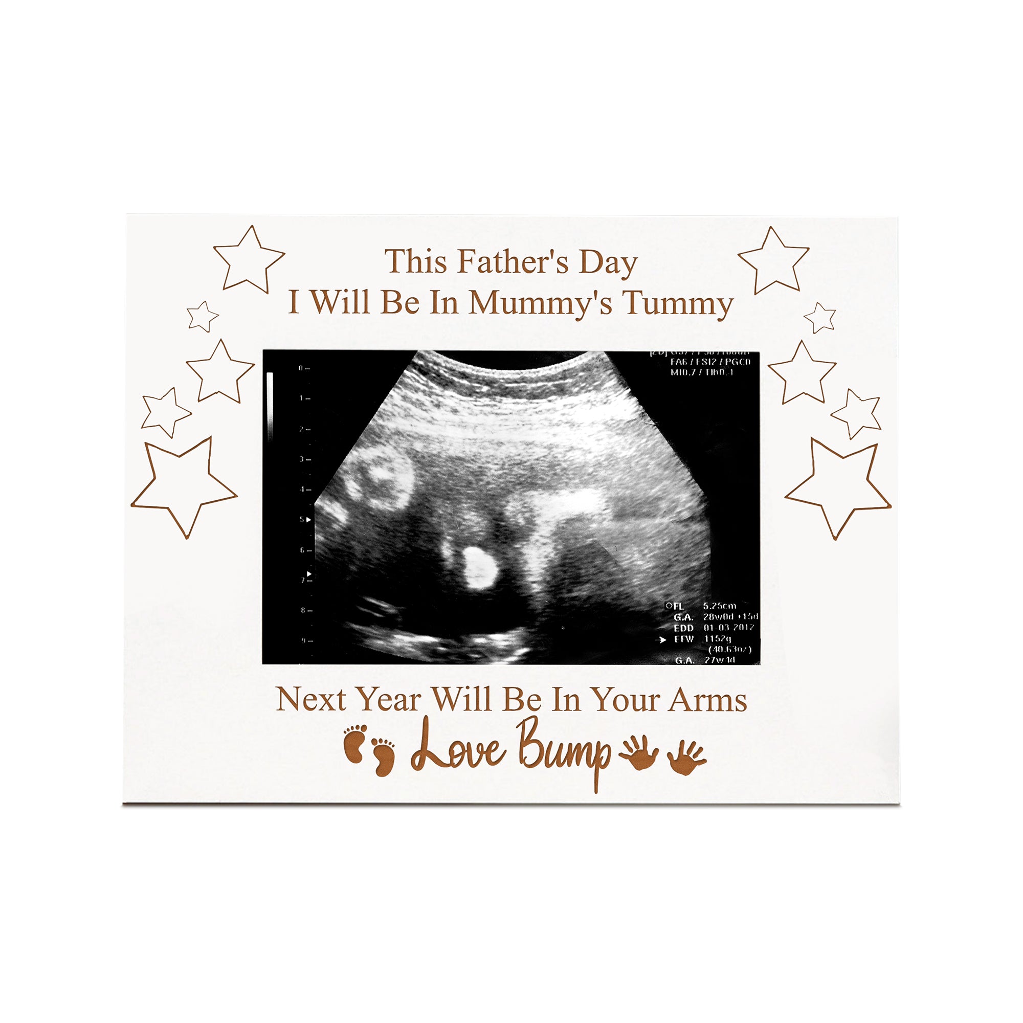 Baby Scan Photo Frame – White Wooden 6x4 Keepsake Gift For Dad To Be Photo Frame ukgiftstoreonline