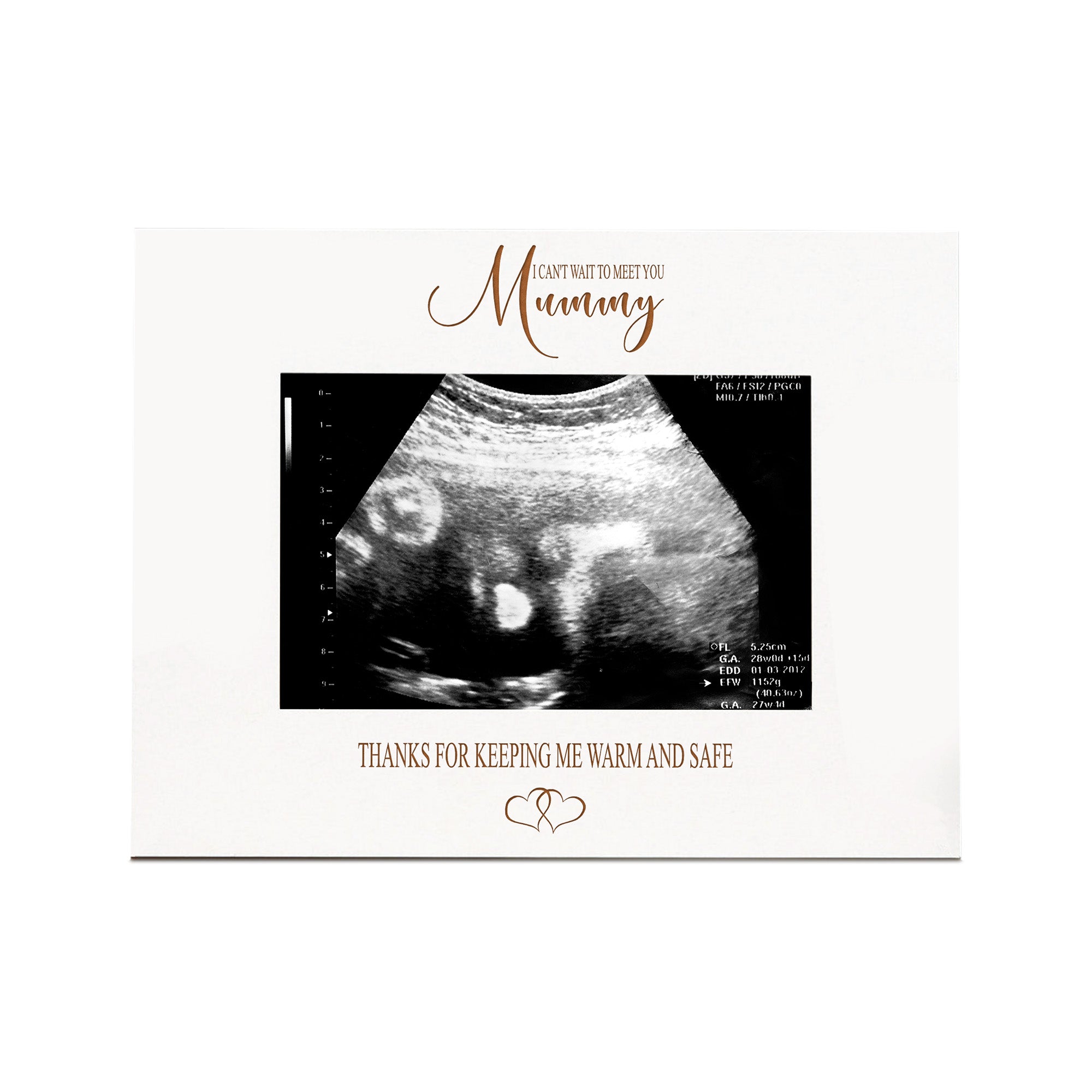 Mum To Be White Wooden Baby Scan Photo Frame Gift Photo Frame ukgiftstoreonline