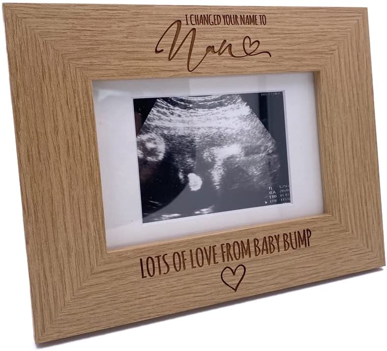 I Changed Your Name To Nan Baby Scan Announcement Photo Frame Photo Frame ukgiftstoreonline